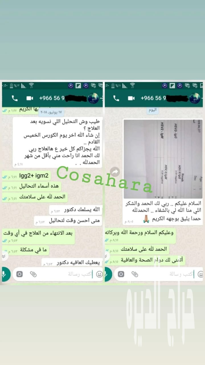 علاج نهائي لفيروس الهربس الفموي والتناسلي وال